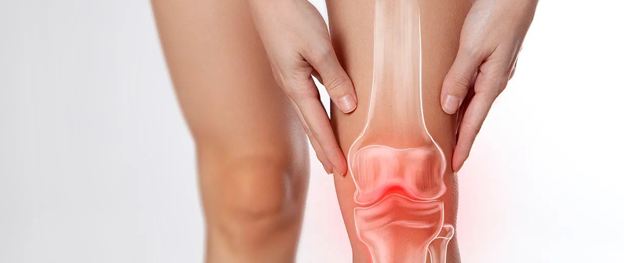 変形膝関節症のイメージ